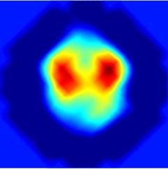 Human head cross-section: one of the first in-vivo images